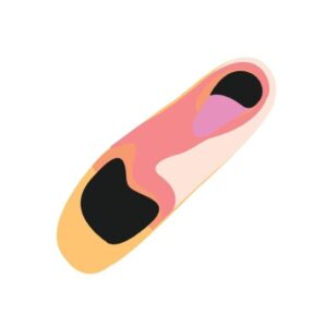 מכון אורטופדי ראשון לציון